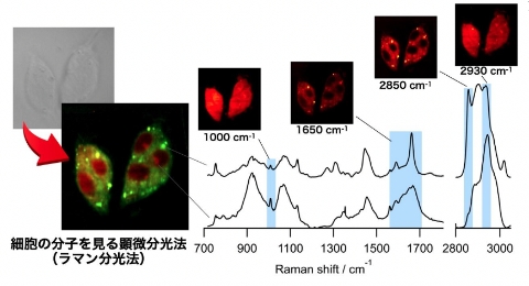 光で見えない病気を「見える化」する